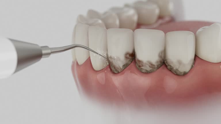 Reliable Dental Implants contractor in Black Earth, WI by Smile Center Dentistry